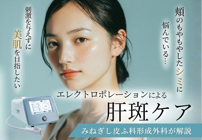 エレクトロポレーションで肝斑ケアしよう！悪化させない治療法を解説