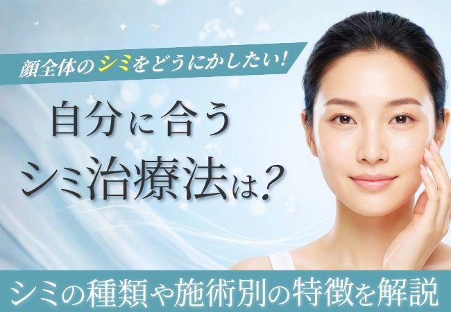 顔全体のシミ取り治療とは？シミの種類や施術別の特徴と注意点を解説のアイキャッチ画像