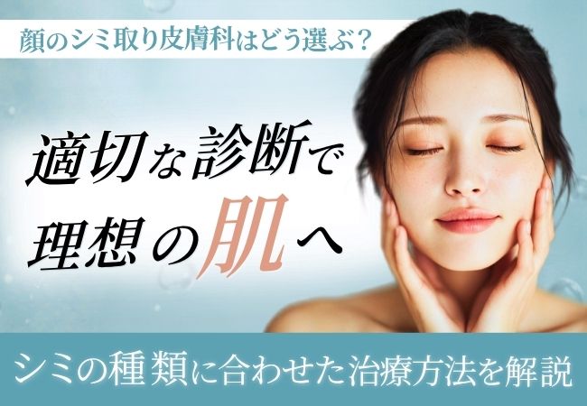 顔のシミ取りを行うには？皮膚科の対処法や注意点を解説
